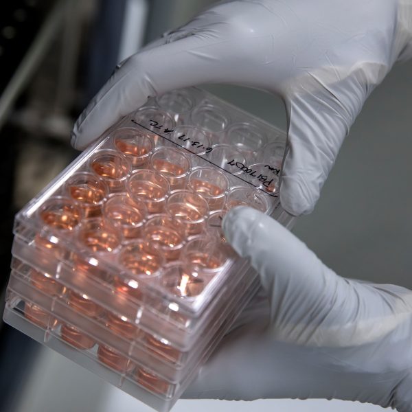 Detail shot of cell culture plates with light orange-colored liquid inside