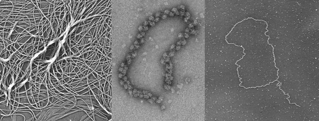 A black-and-white composite image of three separate images taken using electron microscopy. The image on the left shows a tangle of cells that look like threads with some threaded clusters. The middle image is an oblong ring formed by clustered cells. The right image is a very thin thread of cells that form an enclosed loop.
