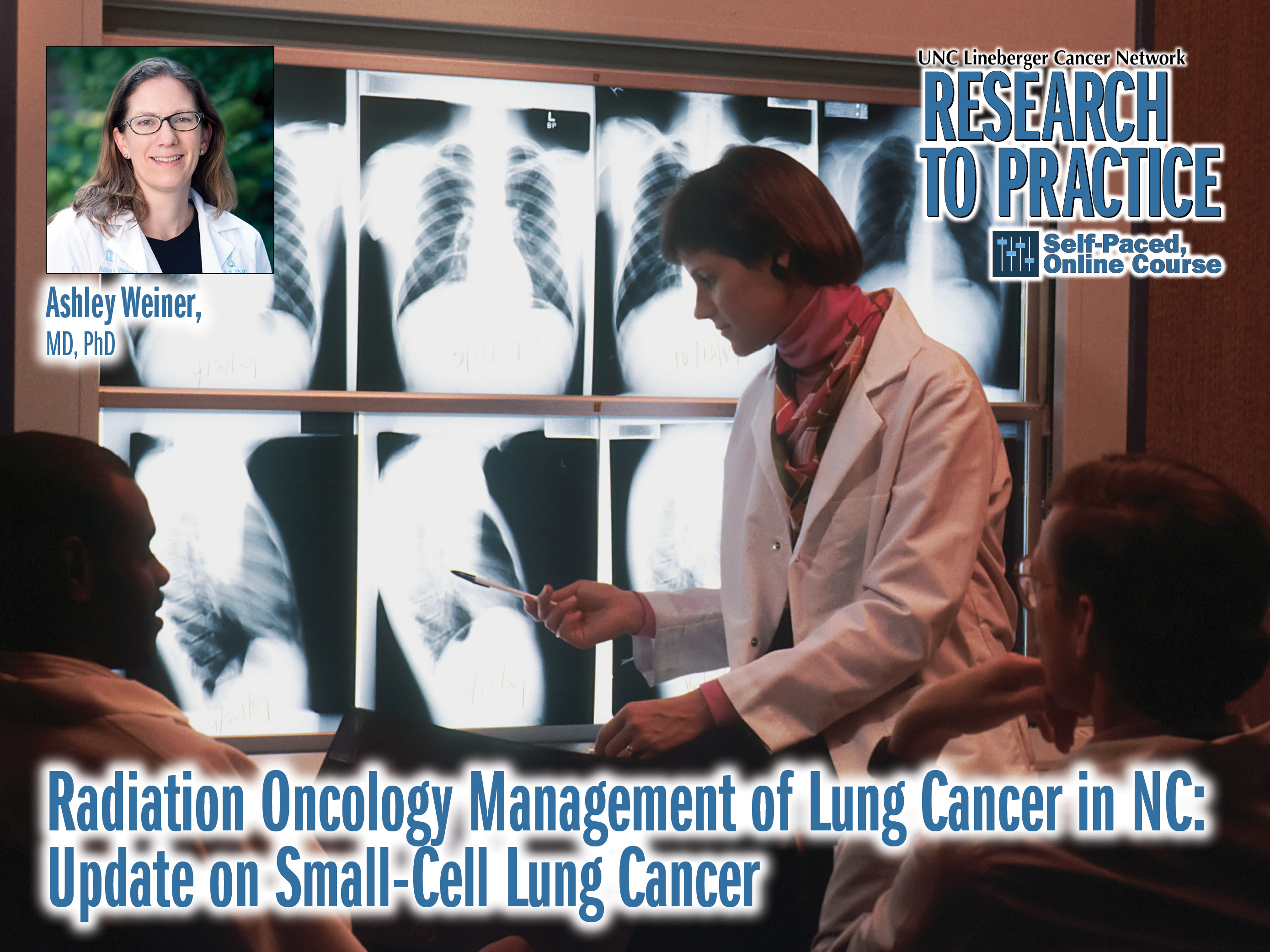 Feature image for Radiation Oncology Management of Lung Cancer in NC: Update on Small-Cell Lung Cancer