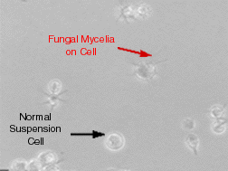 A photo of fungus on cells used to illustrate contamination in cell culture.