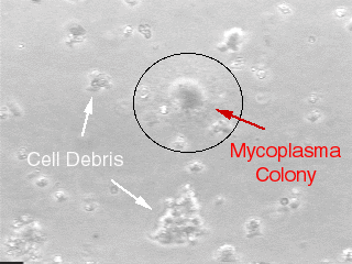  Una foto de una colonia de micoplasma utilizada para ilustrar la contaminación en cultivos celulares.