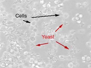 A photograph of yeast in cell culture under a microscope.