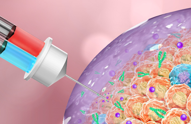 When injected into tumors, this therapy forms a gel to attack cancer cells....