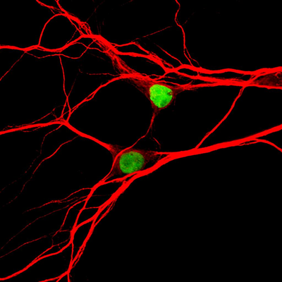 Neurons expressing the Topoisomerase-1 gene (green). Image by Angela Mabb, PhD