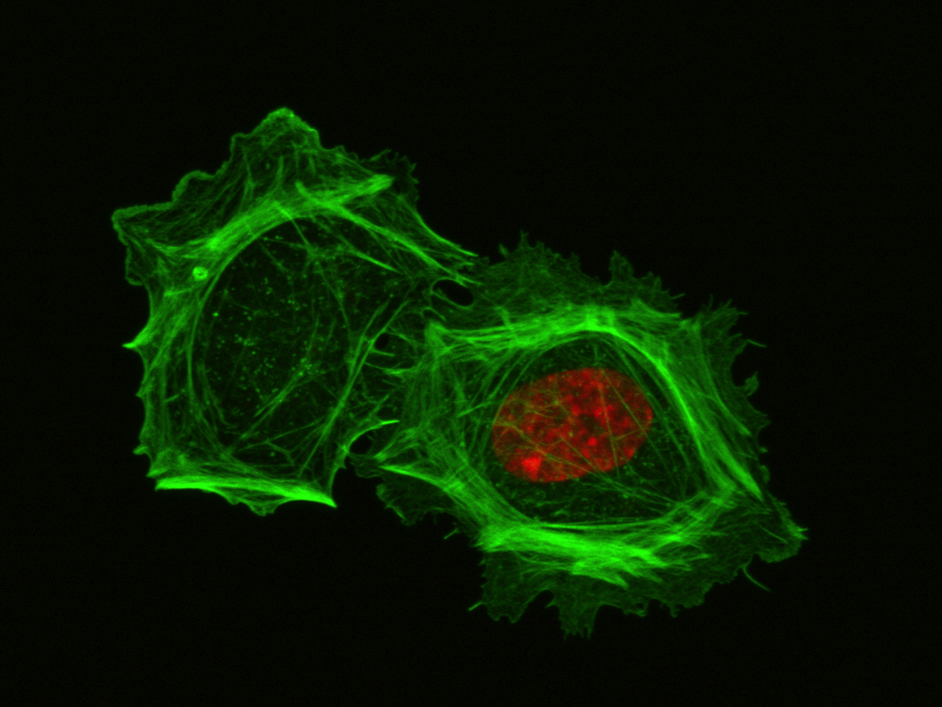 Two human endothelial cells are shown. The cell to the left had its nucleus removed. The cells have been stained with phalloidin to label in green the actin cytoskeleton, and with a different dye to label the nucleus red.