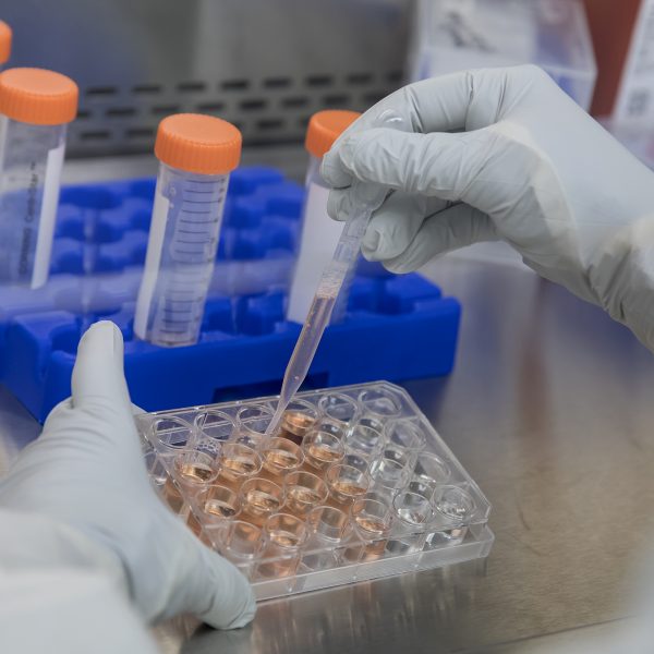 A person changes the culture media on a cell culture plate while working in the cell culture room at the UNC Lineberger Advanced Cellular Therapeutics Facility.
